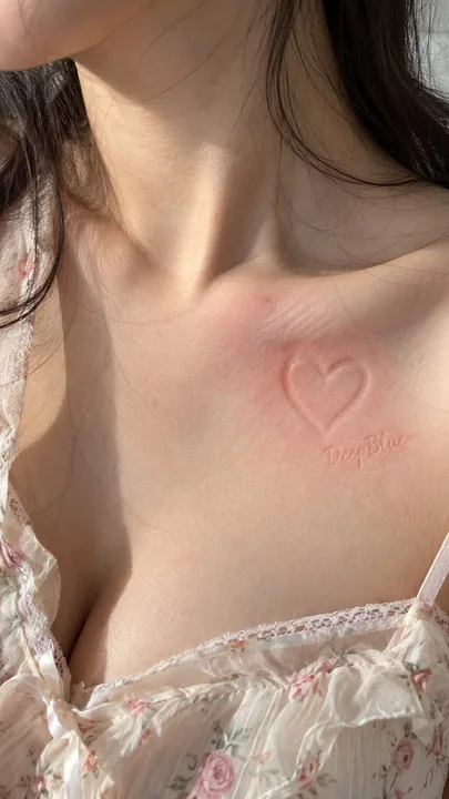 主体身体部位肌肤浅浮雕压痕局部红晕